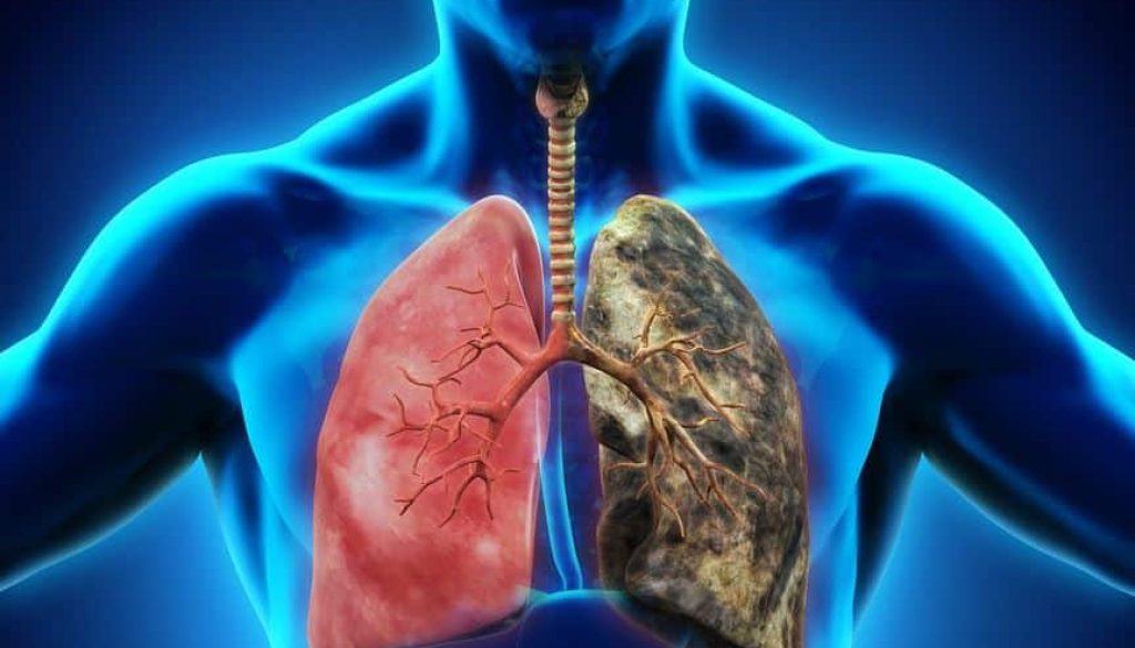 Top 8 Respiratory Diseases in Nepal | Clinic One