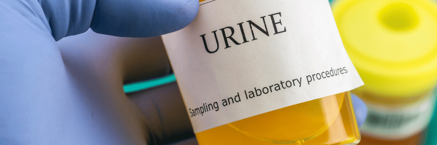 What does Your Urine say About Your Health?