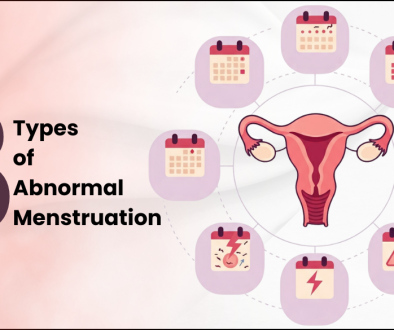 Illustration of the female reproductive system surrounded by calendar icons representing 8 types of abnormal menstruation, including irregular periods, heavy bleeding, and menstrual pain.