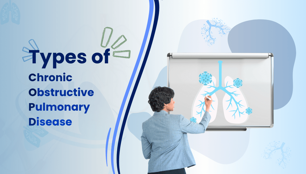 COPD Types The doctor pointed at the lung diagram on the board, illustrating the types of chronic obstructive pulmonary disease (COPD).