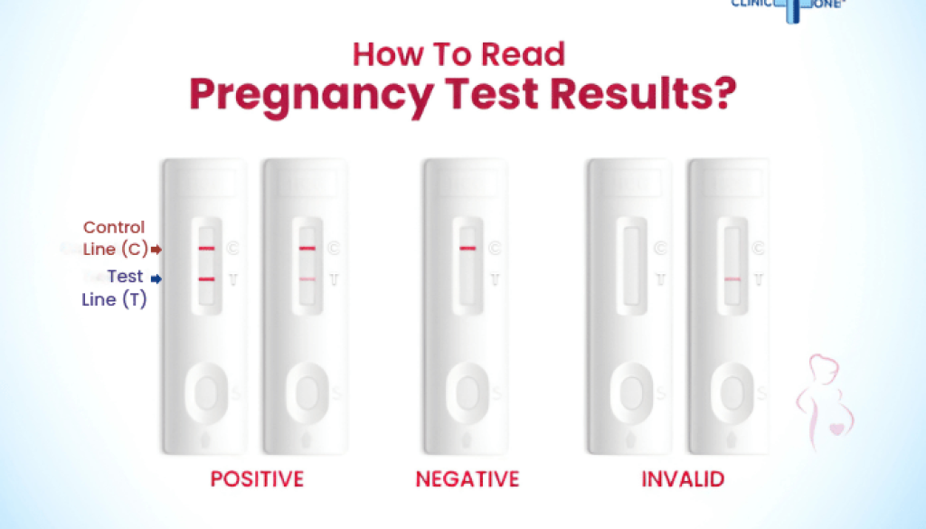 Pregnancy test kit results A graphic illustration of pregnancy test kit results showing positive, negative, and invalid outcomes based on control (C) and test (T) lines.