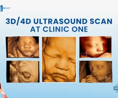 3D and 4D ultrasound in Kathmandu showing clear fetal facial features during pregnancy scan at Clinic One
