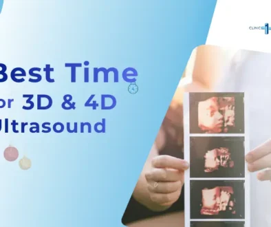 Graphic illustration showing the best time for 3D and 4D ultrasound with parents holding printed 3D baby scan images