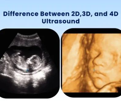 3D vs 4D ultrasound compared with a 2D black and white scan