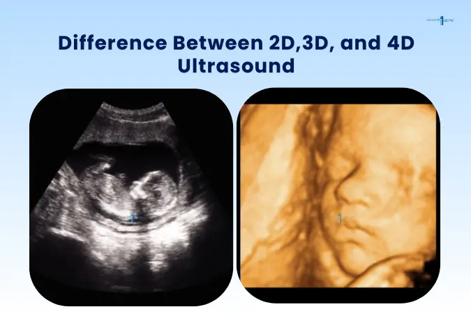 2D vs 3D vs 4D ultrasound : What’s the Difference