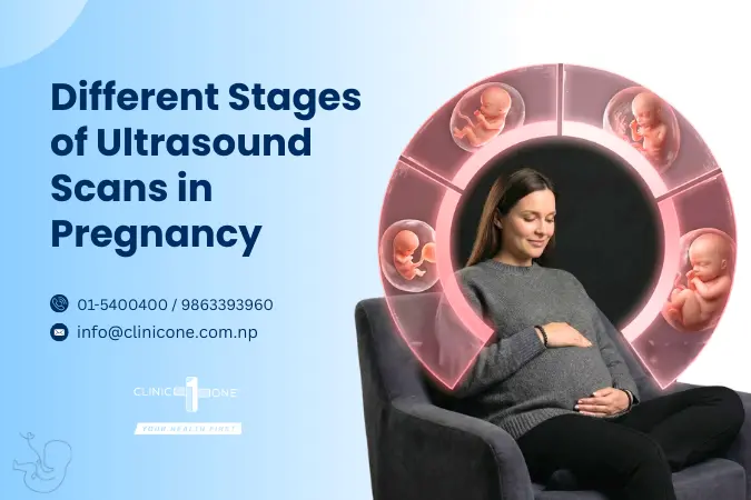 What Are the Different Stages of Ultrasound Scans in Pregnancy?