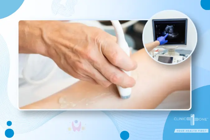 A clear view of a modern examination room, showing high-resolution Doppler equipment focused on a patient’s leg.